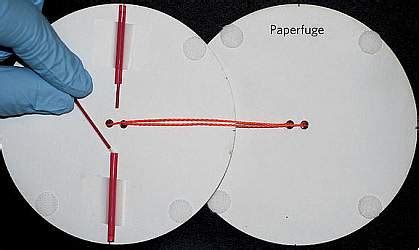 paperfuge low cost centrifuge